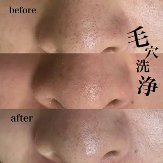 Mr.&Ms.脱毛 /眉毛/りかこのエステ・リラクイメージ