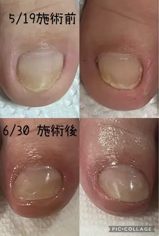ネイル にしだ かなえのネイルデザイン