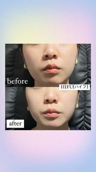 ＋tico _ayanaのマツエク・マツパデザイン