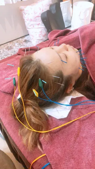 美容鍼灸女性専用 りんご鍼灸治療院のその他イメージ