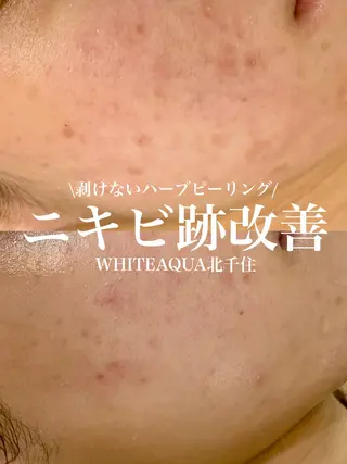 WHITE AQUA 北千住店のエステ・リラクイメージ