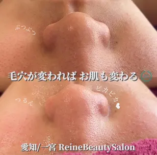 Reine BeautySalon所属・毛穴/シミ肝斑/脱毛 横山梨里のエステ・リラクイメージ