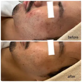 肌質改善美容サロン ému 用賀のエステ・リラクイメージ