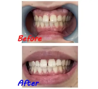 セルフホワイトニングサロン　ラヴィアン所属・ホワイトニングサロン La vie enのその他イメージ