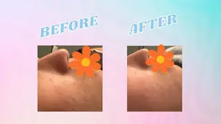 POWER OF BEAUTY所属・🎀TOMO🎀 “””のエステ・リラクイメージ