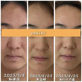 自然由来スキンケア/ 肌質改善/まつパのエステ・リラクイメージ