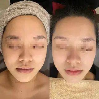 OPREA 千種店のエステ・リラクイメージ