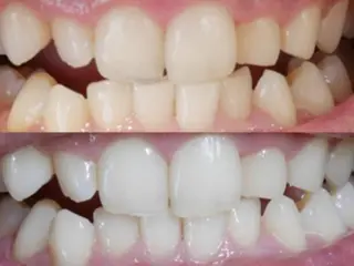 Twinkle White上尾店のエステ・リラクイメージ