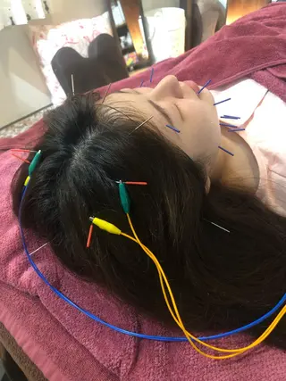 美容鍼灸女性専用 りんご鍼灸治療院のその他イメージ