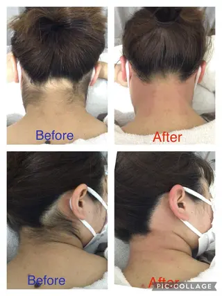 子宮矯正/腸揉み/ シュガーリング脱毛のエステ・リラクイメージ