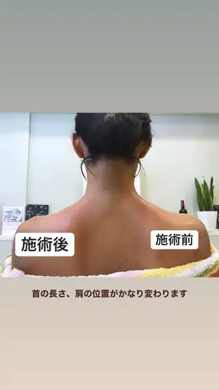 肩首こり×痩身×浄化 🌿リンパエステのエステ・リラクイメージ
