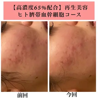 Bellesthe (ベルエステ)のエステ・リラクイメージ