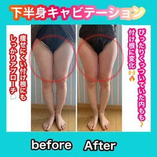 痩身/脱毛/ネイル HARUKAのエステ・リラクイメージ