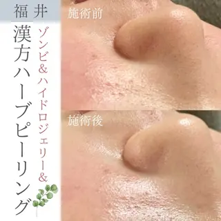 毛穴ケア専門サロン Yourmeユアミーのエステ・リラクイメージ