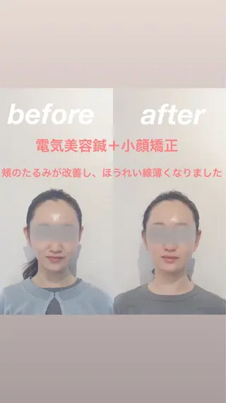 経堂鍼灸整体院 古木のエステ・リラクイメージ