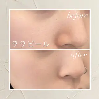 🦋美肌サロン. maho🦋のエステ・リラクイメージ