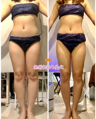 ショート カラー パーマ ヘアアレンジ メンズ キッズ ネイル マツエク・マツパ 痩身&ボディ 結果出し🌟丹野のエステ・リラクイメージ