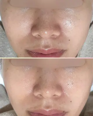 s o i n a🤍🪽ララピール/毛穴/小顔/水光肌所属・s o i n a 神楽坂のエステ・リラクイメージ