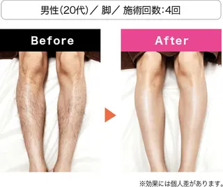 メンズ エステ.まつげ.小顔 眉毛.プラズマ.脱毛のマツエク・マツパデザイン