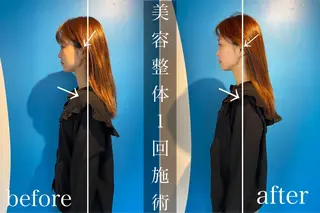 鍼灸整骨院Refine所属・鍼灸 Refineのその他イメージ