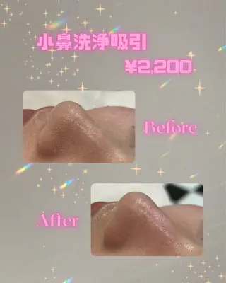 新宿シェービング🌙 清水あみのその他イメージ