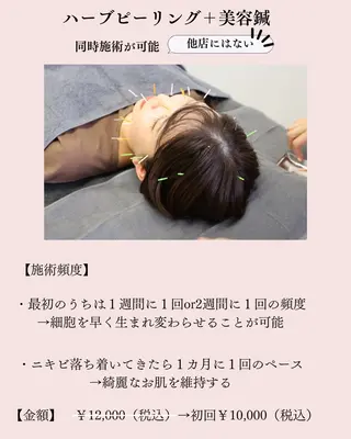 ニキビ特化美容鍼 ×ハーブピーリングのエステ・リラクイメージ