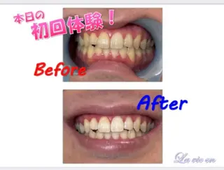 セルフホワイトニングサロン　ラヴィアン所属・ホワイトニングサロン La vie enのその他イメージ