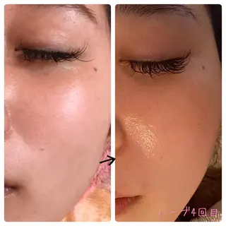 フェアリーローズ所属・fairyrose organicエステのエステ・リラクイメージ