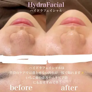 メンズ 🌿肌質改善サロン. 宮里🌿のエステ・リラクイメージ