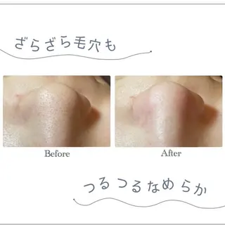 韓国肌管理 白玉肌管理®︎のエステ・リラクイメージ