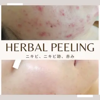 SalonLeaf所属・SalonLeaf Yukoのエステ・リラクイメージ