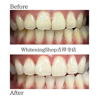 ホワイトニング ショップ吉祥寺店のエステ・リラクイメージ