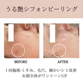 肌質改善専門サロン Bellmi/心斎橋のエステ・リラクイメージ