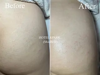 HOTEL&PARK . ワックス脱毛のエステ・リラクイメージ