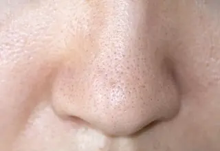 米山 美紀子のエステ・リラクイメージ