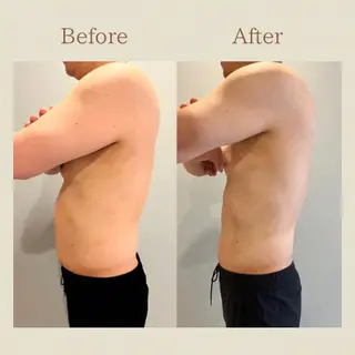 お腹痩せエステ Flat BELLY 恵比寿所属・【腸もみ/脂肪冷却】 お腹エステ/恵比寿のエステ・リラクイメージ