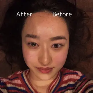 美容鍼灸サロン LOMIHARIのエステ・リラクイメージ