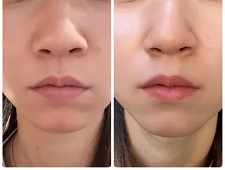 小顔/たるみ/黒ずみ除去専門サロン/SONA 大和西大寺店所属・【小顔専門看護師 サロンSONA】のエステ・リラクイメージ