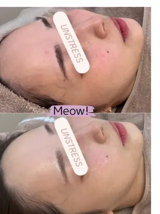 Meow！～トラブル肌専門ピーリング＆脱毛サロン～所属・トラブル肌改善🏥 Meow！🫧🫧のエステ・リラクイメージ