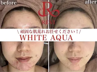 WHITE EYE 川口所属・中村 恵美子のエステ・リラクイメージ