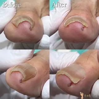 ネイル 東京巻き爪アカデミー所属・東京巻き爪 アカデミーのエステ・リラクイメージ