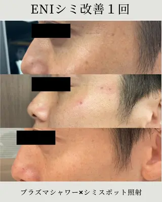 シミ毛穴ケア EsteAのエステ・リラクイメージ