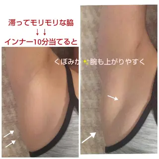 【ニキビ/肌管理】 salon varyのエステ・リラクイメージ