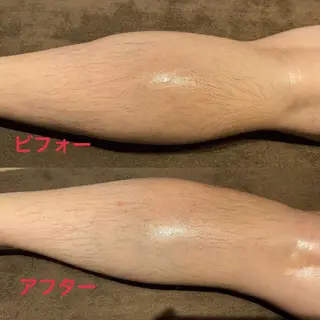 調律エステ /美KISSのその他イメージ