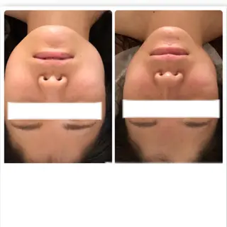 FLEUR大阪・美容 整体・痩身・小顔のエステ・リラクイメージ