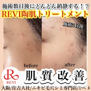 salon  mebell所属・肌管理専門店 mebell天王寺店のエステ・リラクイメージ