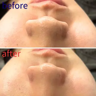 毛穴洗浄特化🫧 オオツカのエステ・リラクイメージ