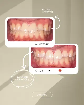 セルフホワイトニングサロンsourire所属・加藤 愛菜のその他イメージ
