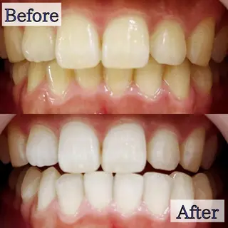 LBSホワイトニング 新宿店💝店長熊倉のその他イメージ