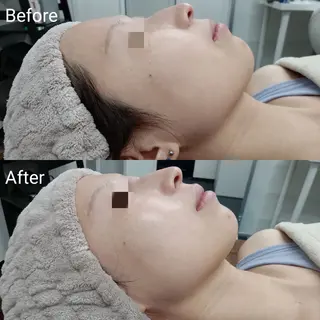 肌質改善Beauty salon Renのエステ・リラクイメージ